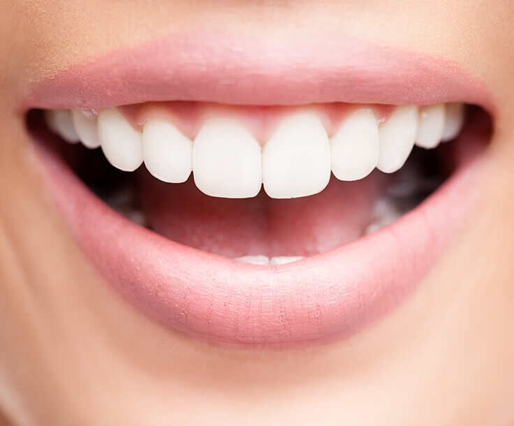 closeup of a bright, white smile